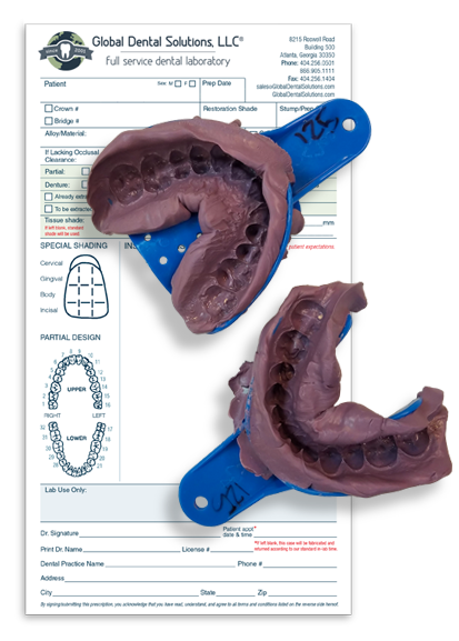 Teeth Mold for Mouth Guard