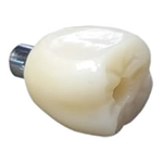 Screw Retained Dental Crown at Global Dental Solutions