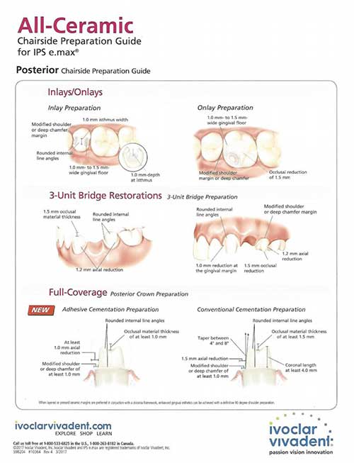 IPS E.max Preparation Guide at Global Dental Solutions in Atlanta, GA