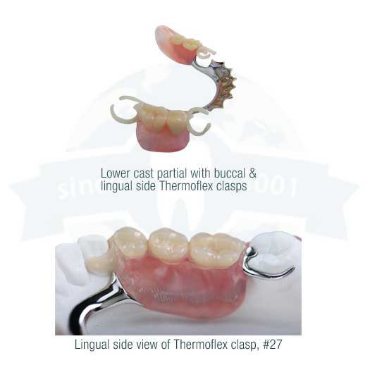 Thermoflex Tooth Color Injected Clasps