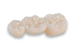 Ceramic Restorations by Global Dental Solutions