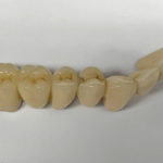 The teeth for Tube Attachments from Global Dental Solutions at Atlanta, GA