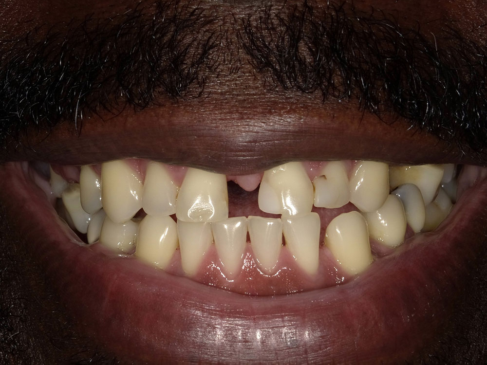 X0966538 Global Dental Solutions