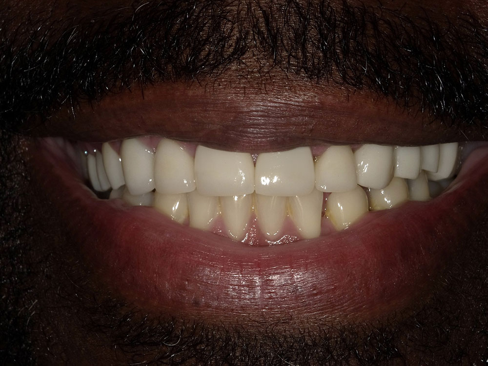 X0966565 Global Dental Solutions