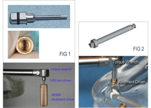 The Placement of the LOCATOR implant abutment in dental