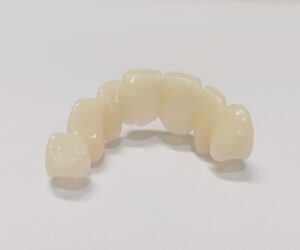 The Pre-operative model part of fake teeth in Atlanta, GA