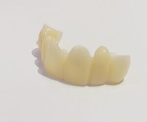 The temporary half white wax for teeth at Atlanta, GA