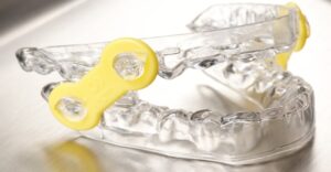 Invisible EMA elastic strap from Global dental solutions at Cheektowaga, NY