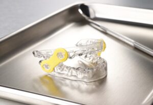 Elastic Mandibular Advancement teeth aligner