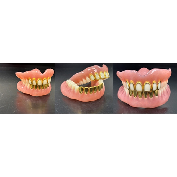 A close-up view of full-mouth 22K yellow gold teeth dentures available across the USA