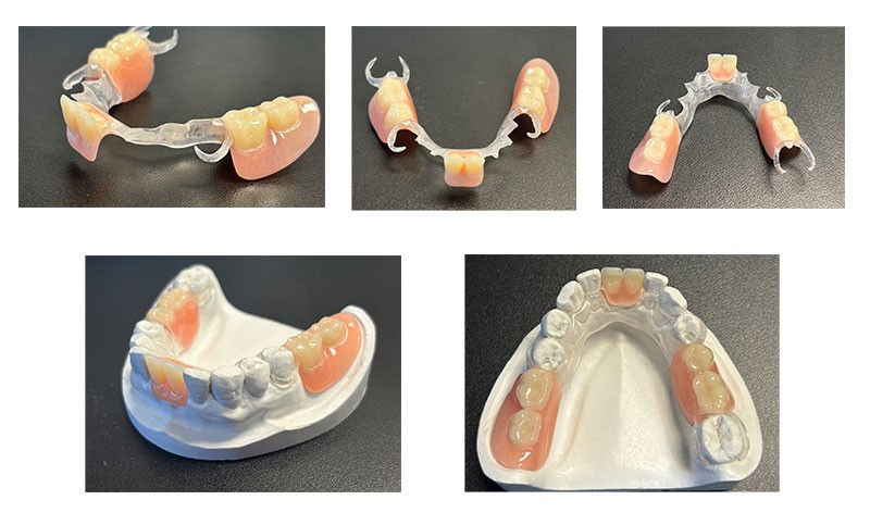 Clear flexible framework partials