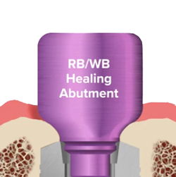RB-WB-bone-growth-new