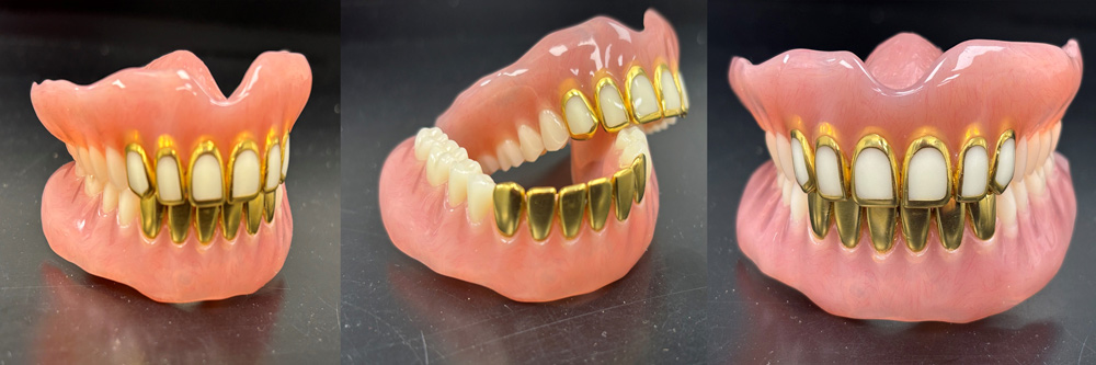 full mouth gold teeth dentures